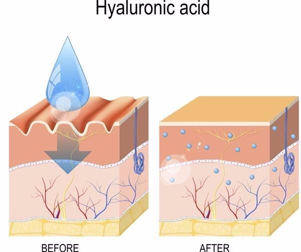 Hyaluronic Acid dưỡng da giữ ẩm